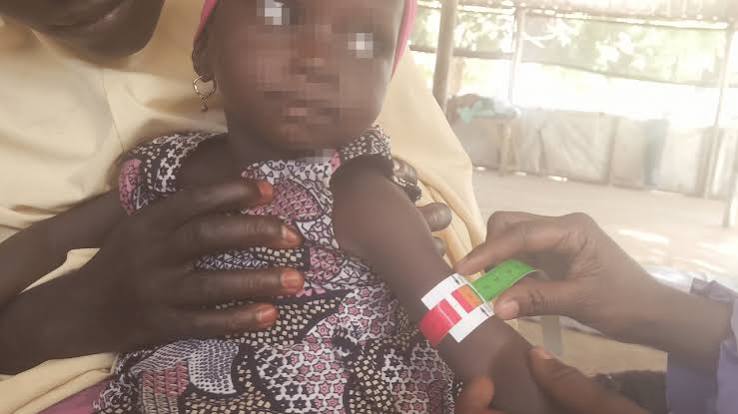 Katsina Seeks Continued Partnership on Child Health and Immunisation
